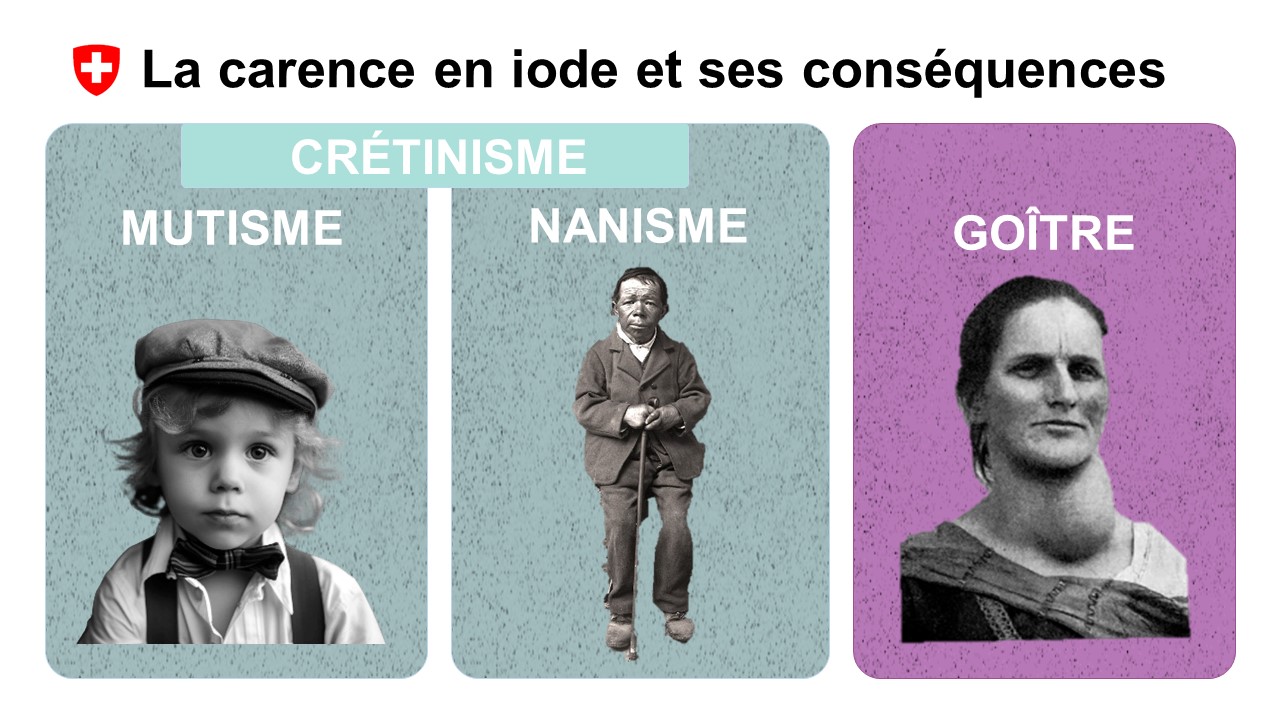 Les conséquences d’une carence en iode sont le développement de goître ainsi que le crétinisme, qui comprend le mutisme et le nanisme. A l’époque, ils étaient très répandus en Suisse.